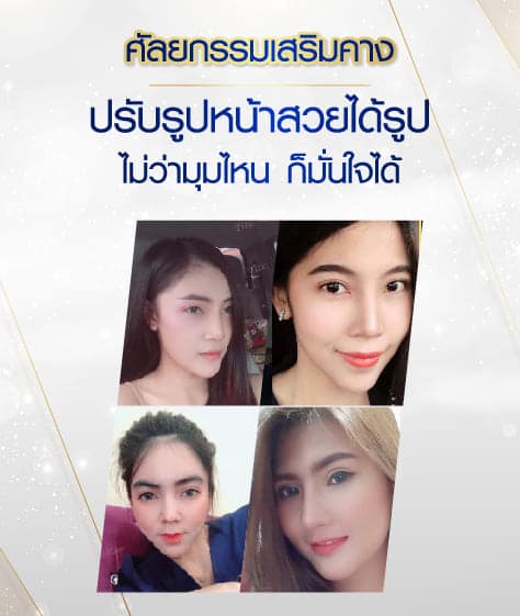 ภาพ cover หน้าบริการ 3 ภาพ-05