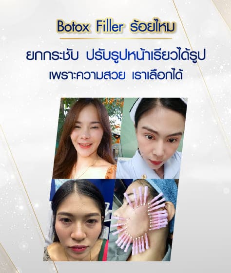 ภาพ cover หน้าบริการ 3 ภาพ-06