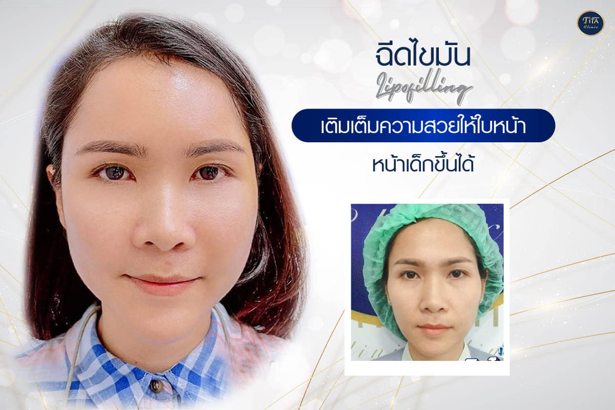 หน้าบริการ11,20-02