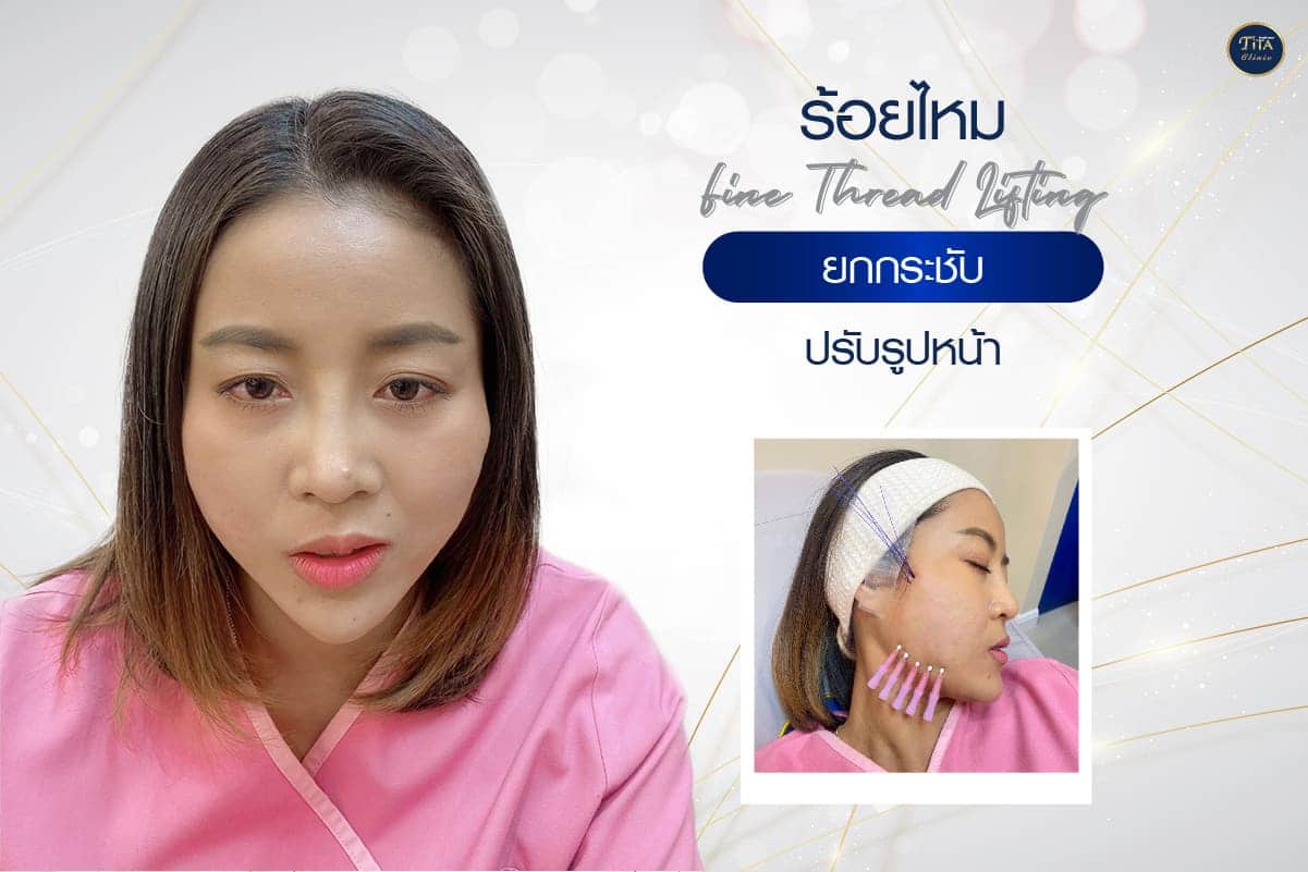 หน้าบริการ11,20-04