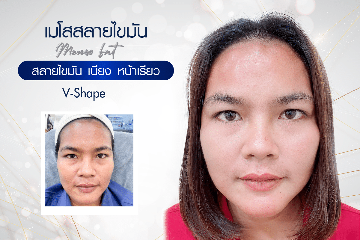 หน้าบริการ11,20-07
