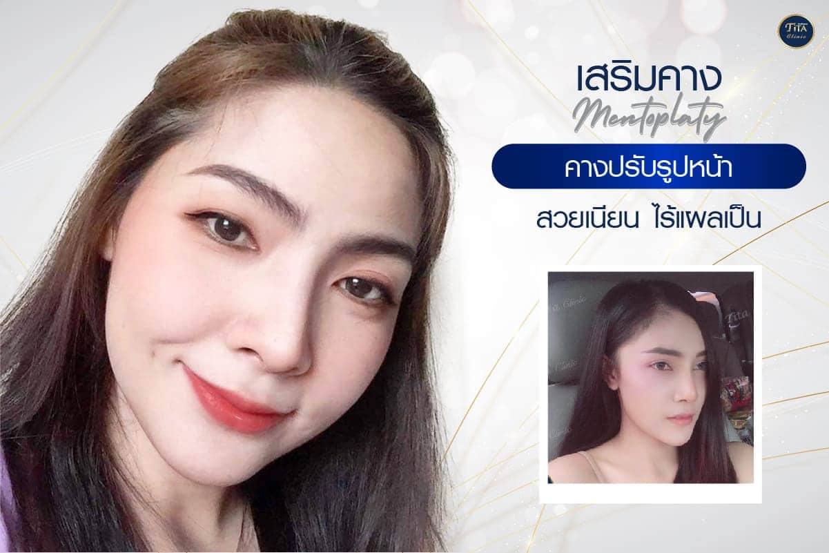 หน้าบริการ5,10-04