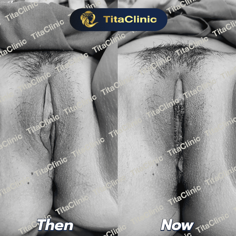 tita_Revive_01