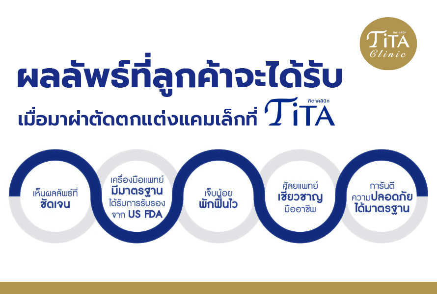 LABIA ผ่าตัดตกแต่งแคมเล็ก