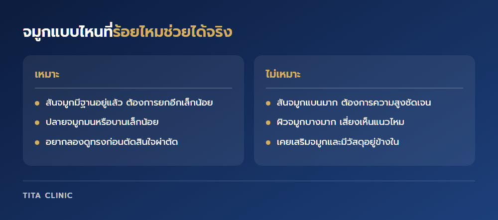 จมูกแบบไหนที่ร้อยไหมช่วยได้จริง