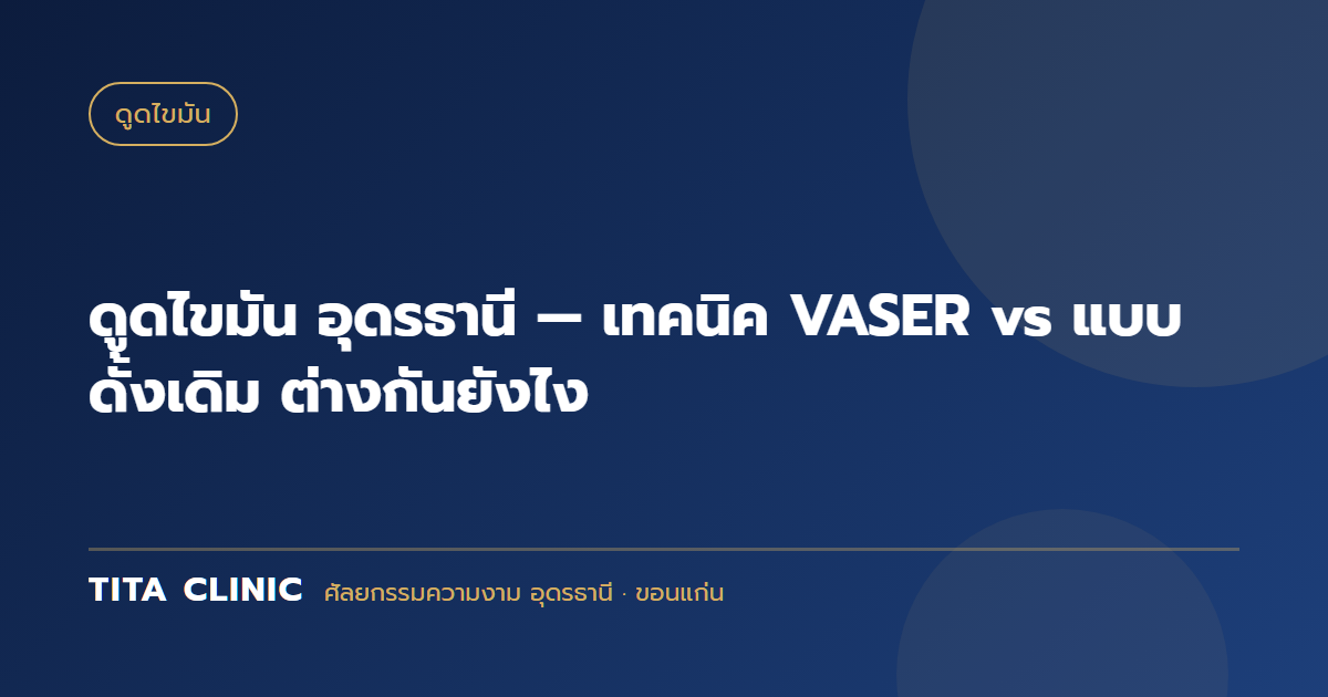 ดูดไขมัน อุดรธานี — เทคนิค VASER vs แบบดั้งเดิม ต่างกันยังไง