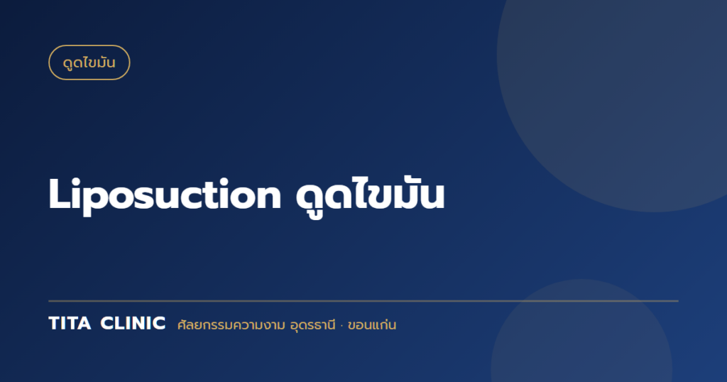 Liposuction ดูดไขมัน