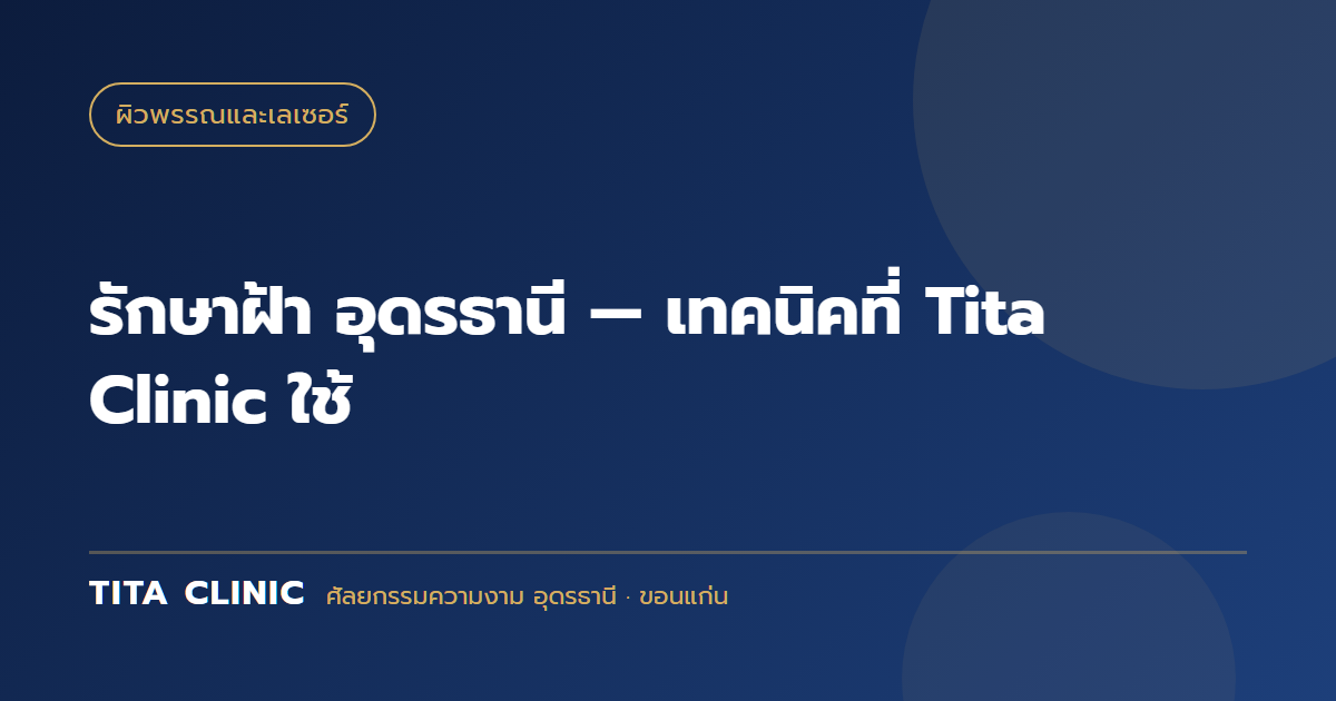 รักษาฝ้า อุดรธานี — เทคนิคที่ Tita Clinic ใช้
